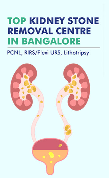 Best Urology Nephrology Hospital in Bangalore