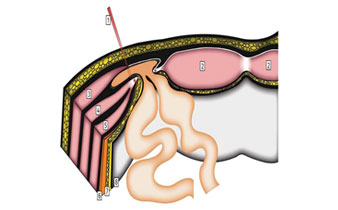 rectus2