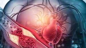 Read more about the article What is Vascular Surgery? What do you need to know?