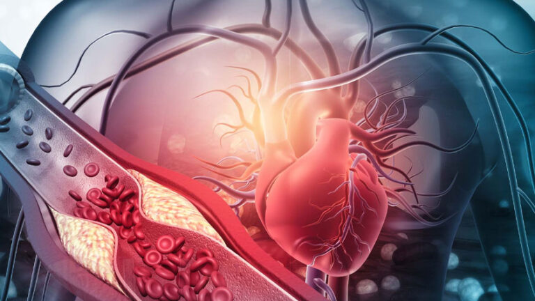 What is Vascular Surgery? What do you need to know?