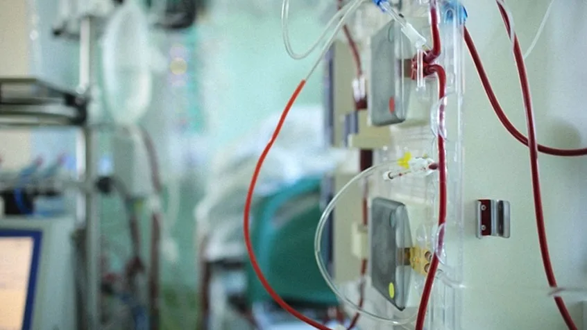 Dialysis-Unit-sevice