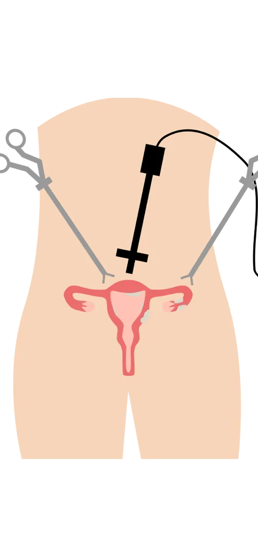 General-Laparoscopy-Surgery-icon