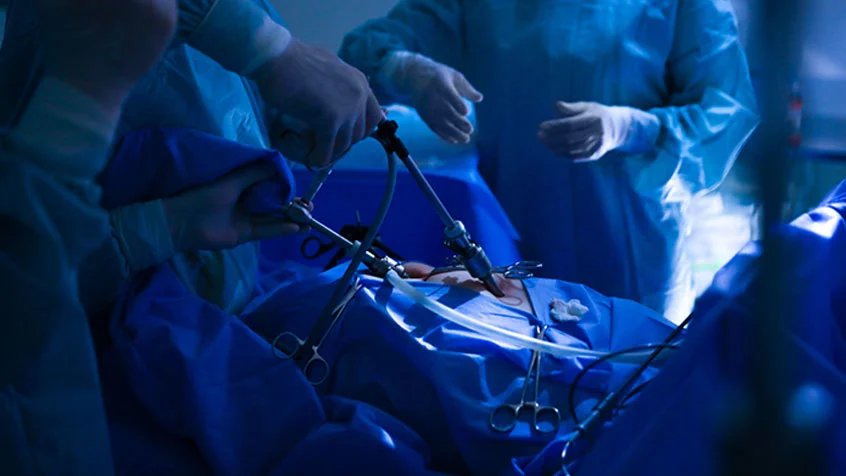 General-&-Laparoscopy-Surgery-service