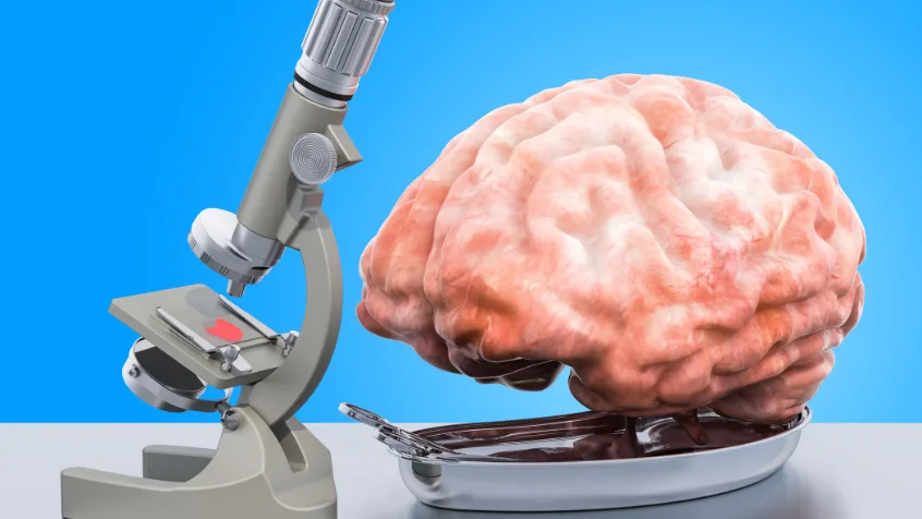 Neuro Sciences service page
