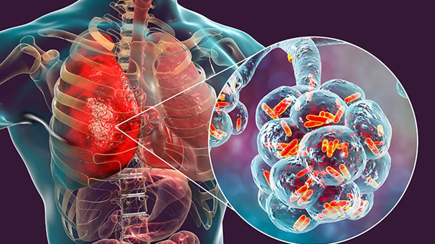 Pulmonary-Medicine-sevice