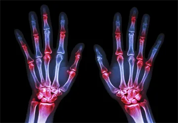 radiologyrheumatology