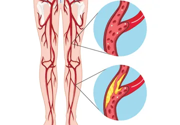 vascular surgery