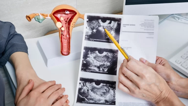 Top 10 Gynaecology Symptoms Every Woman Shouldn’t Ignore