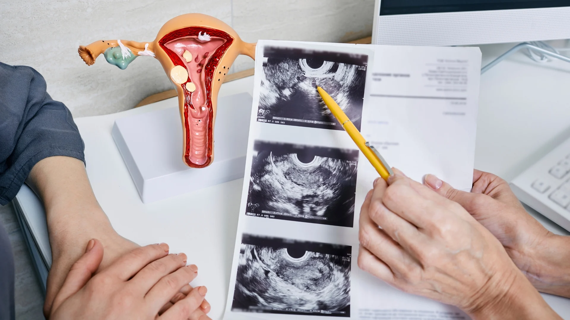 Top 10 Gynaecology Symptoms