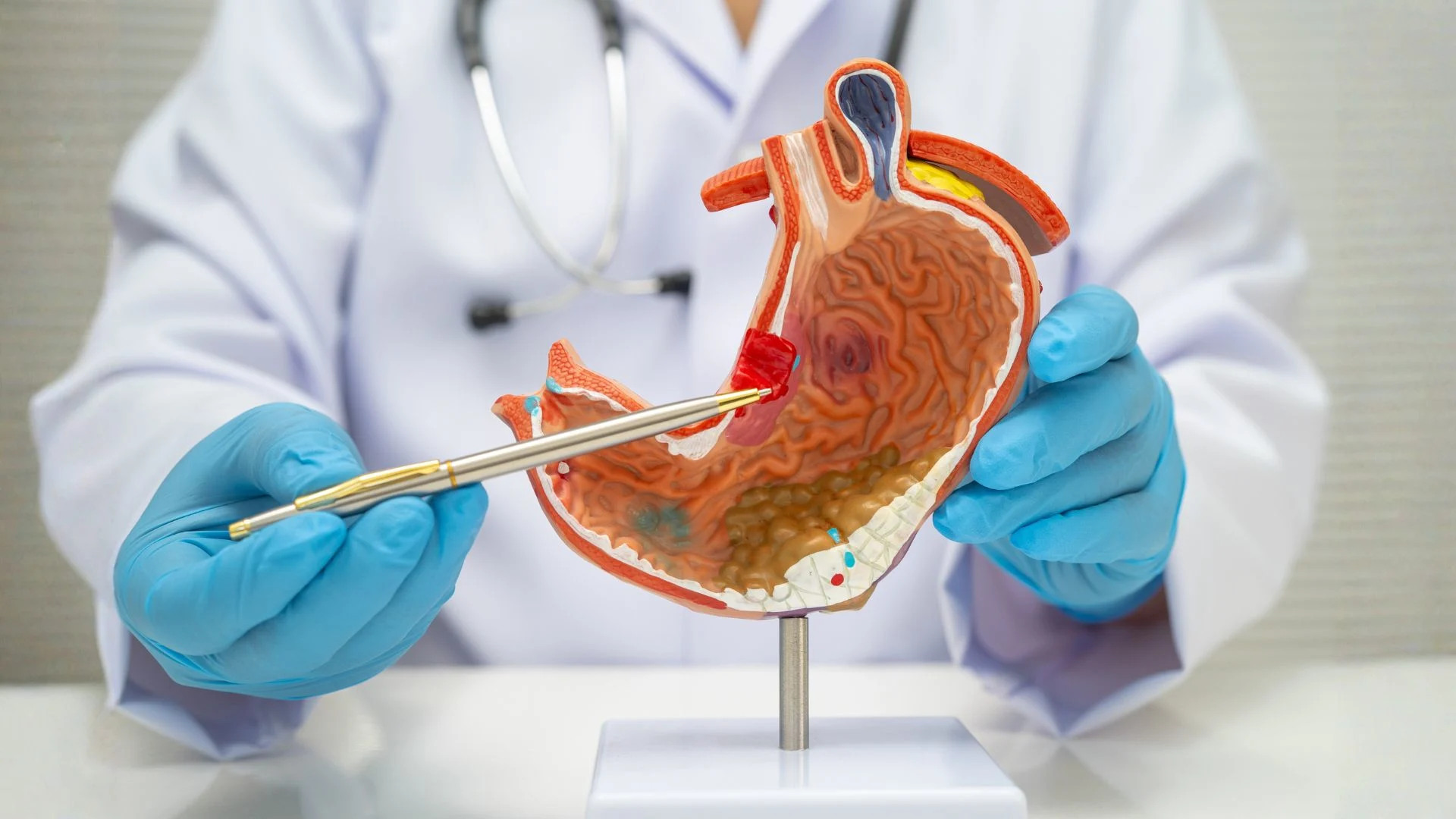 Top 5 Digestive Problems and When to See a Doctor